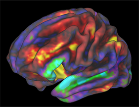 fMRI image of preteen brain while child performs a working memory task, released by ABCD researchers.
